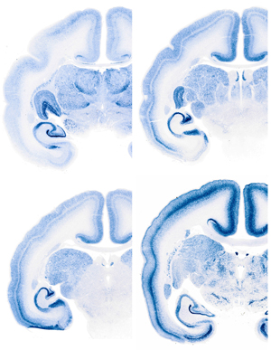 Image of brain sections