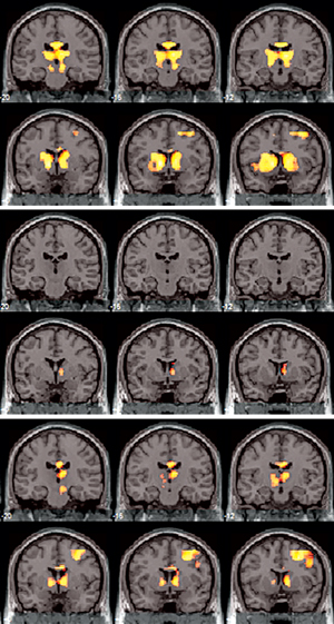 Image of brain activity