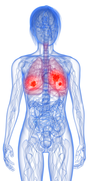 Image of human body and breast cancers