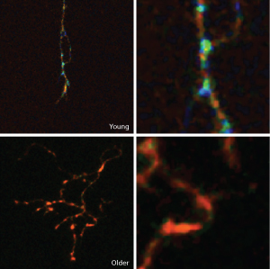 Image of axons