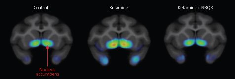 PET scan image of a monkey brain