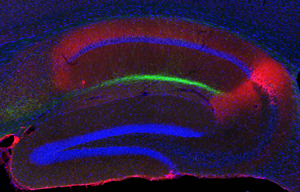 Image of the hippocampus