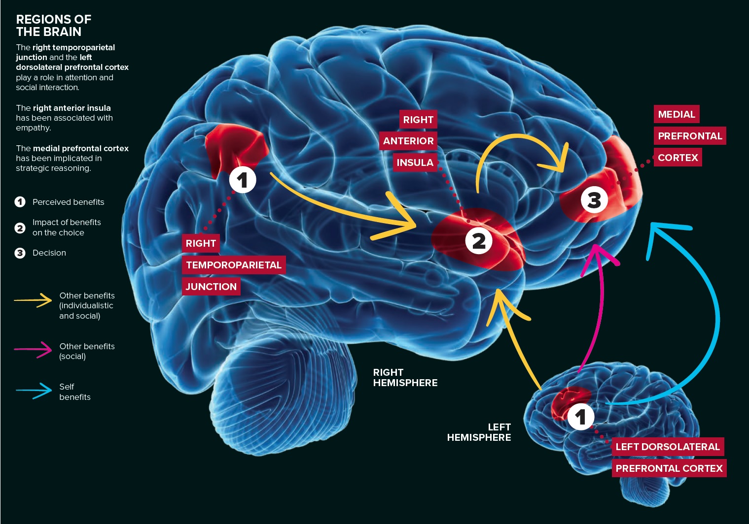 Image of regions of the brain