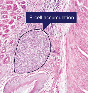 Image of B cell accumulation