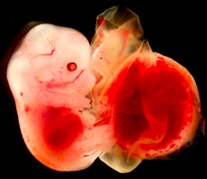 Image of an embryo