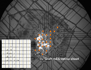 image of retina sheet