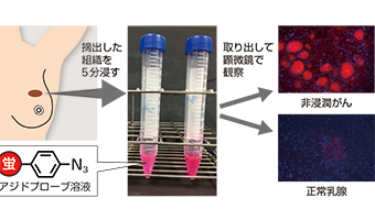 アジドプローブを用いた手術中がん診断の図