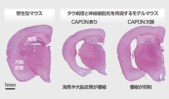 CAPONによるタウ病理・神経細胞死の促進の図