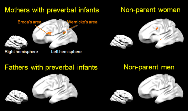 brain regions for infant directed speech
