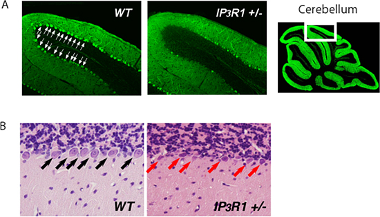 images showing cell death caused by loss of IP3R1