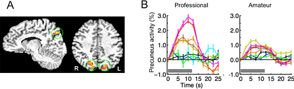 Figure showing that specific activation of the posterior precuneus