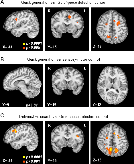 Figure showing activations in amateur players