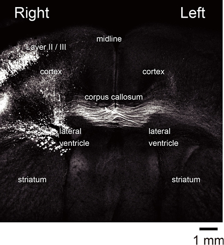 Photo showing labeled callosal connections in the intact mouse brain.
