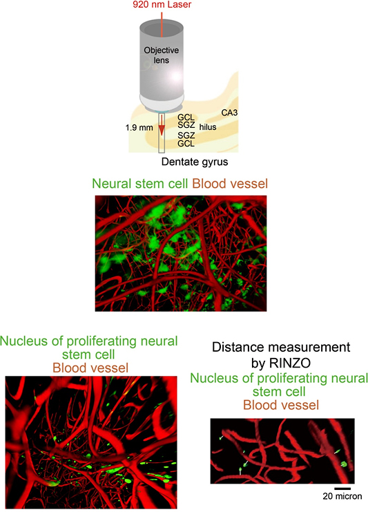 Schematic diagram showing the approach of TPEFM imaging to a cleared excised hippocampus.