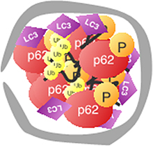 Illustration showing polyubiquitinated proteins in a sequestome