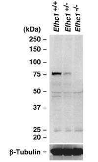 野生型マウス、Efhc1変異ヘテロ接合体（＋/－）、ホモ接合体（－/－）に、抗ミオクロニン1抗体を用いたウェスタンブロット解析の画像