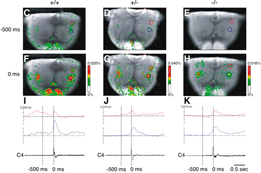 電位依存性色素を用いた新生マウス摘出脳幹―脊髄標本における呼吸中枢の解析の図