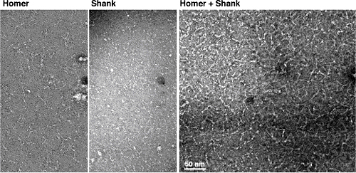 Homer単独、Shank単独およびHomerとShankの複合体の負染色による電子顕微鏡像の画像