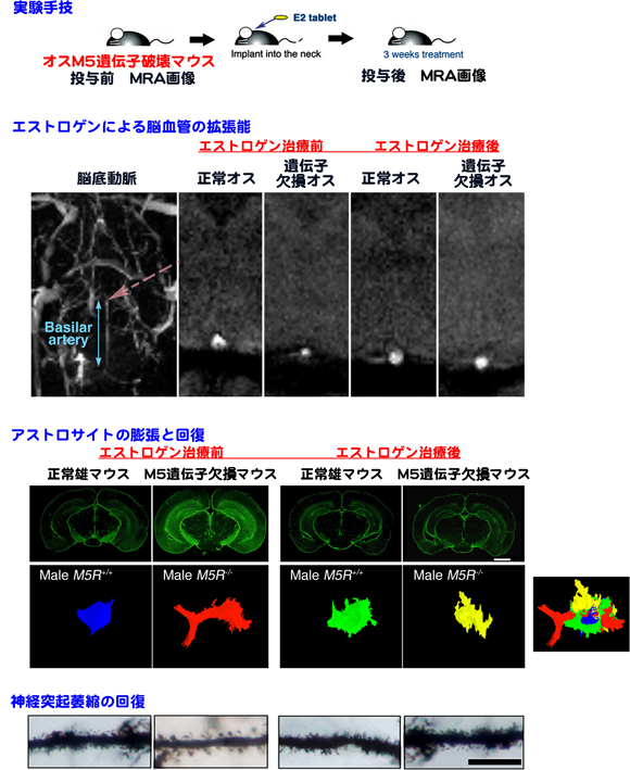 脳循環低下によるアストロサイトの膨張とエストロゲンの効果の画像