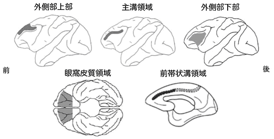 5種類の大脳皮質破壊領域の図