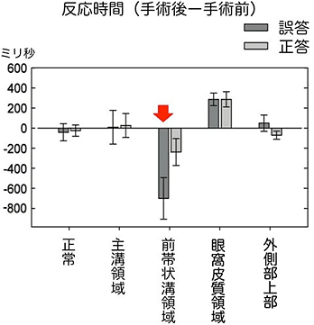 反応時間の変化の図