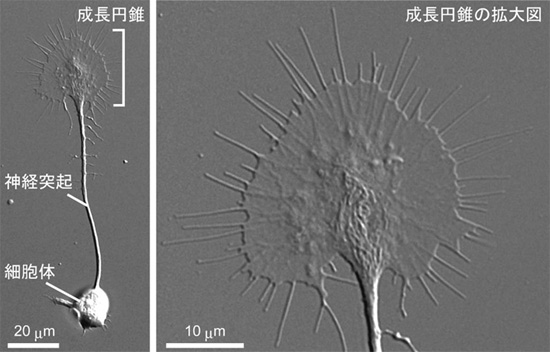 神経突起と成長円錐の形態の図