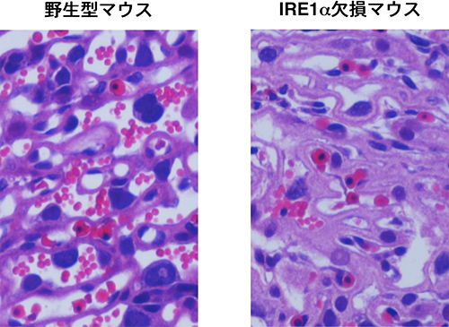 野生型マウスとIRE1αを欠損させたマウスの胎盤迷路部の組織切片の図