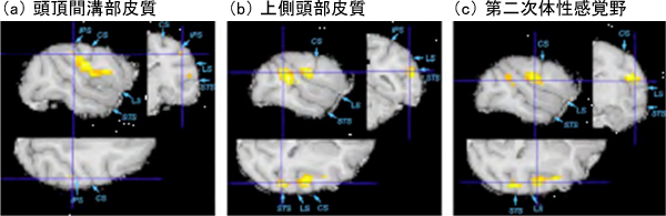 習熟に伴って膨らんだ脳部位の図