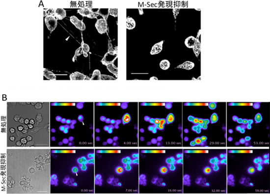 マクロファージ細胞株のM-Sec発現抑制による細胞膜ナノチューブ形成とカルシウムシグナル伝達の阻害の図