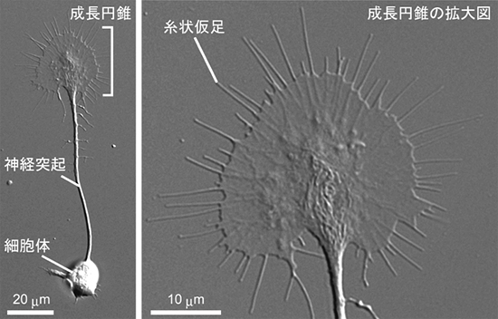 神経突起と成長円錐の形態の図