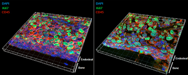 サイトカイン投与による白血病幹細胞の細胞周期の変化の図