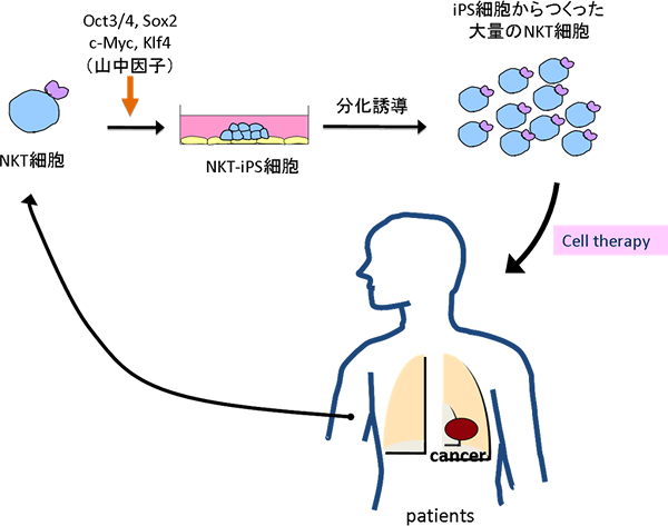 抗がん治療に有効なNKT細胞療法モデルの図