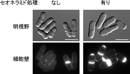 細胞壁の異常合成（スケールは10μm）の図