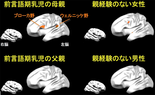 他人のマザリーズ音声を聞いたときの脳活動の図