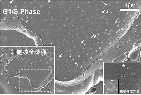 電子顕微鏡像で捉えた核膜孔複合体形成中間体の図