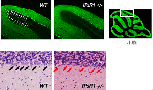 IP3R1の欠損は、小胞体ストレスにおいて神経細胞死を誘導するの図
