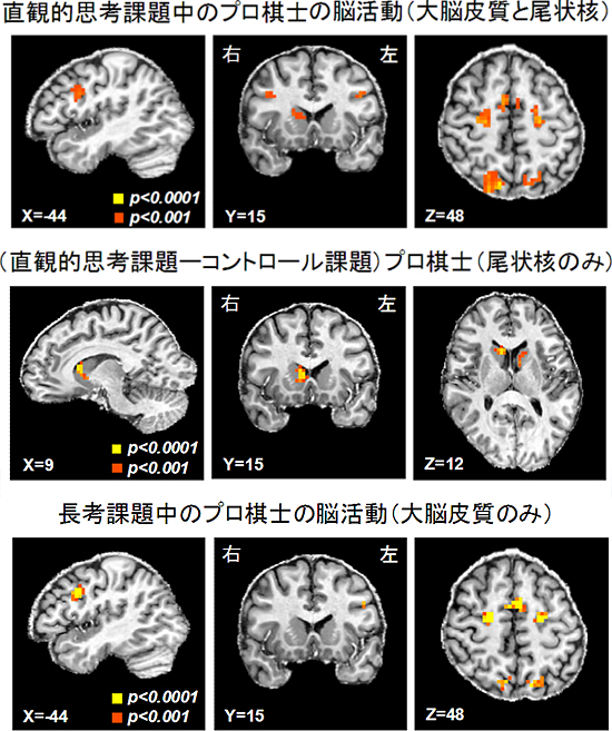 直観的思考に関連する脳活動（上）とプロ棋士固有の脳活動（下）の図