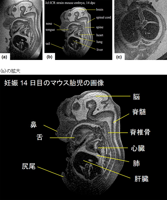 マウス胎児のMRＩ画像の図