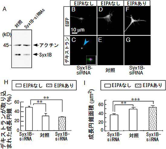 Syntaxin1Bはマクロピノサイトーシスの負の制御因子の図