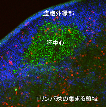 リンパ節を薄くスライスして染色した胚中心及びその周辺の像の図