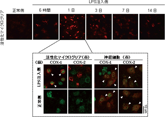 LPS注入後のマイクログリアの活性化と細胞特異的なCOX発現パターンの図