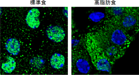 膵臓β細胞内の転写因子FOXA2の局在 (緑:FOXA2、青:核)の図