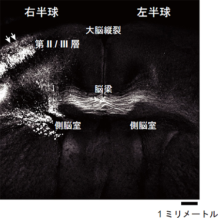 右半球から左半球へ投射する神経線維束の図