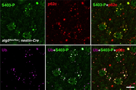 オートファジー欠損マウスの神経細胞に蓄積する封入体はS403リン酸化型p62を含むの図