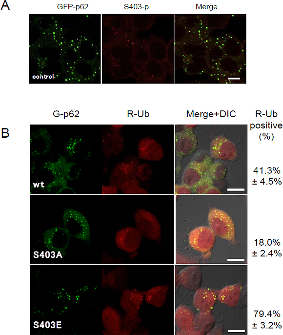 S403リン酸化型p62はp62小体に局在し、ユビキチン化タンパク質を隔離するの図