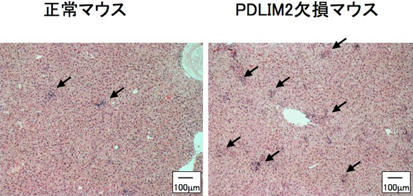 PDLIM2欠損マウスにおける肝臓の肉芽腫形成の促進の図