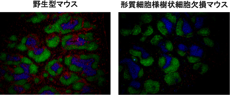 形質細胞様樹状細胞欠損マウスの脾臓の免疫組織染色の図