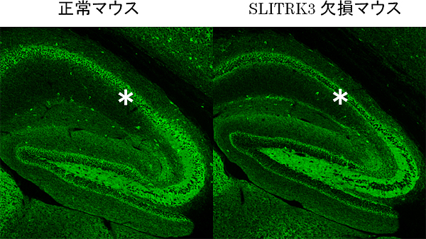 SLITRK3欠損マウスの海馬での抑制性シナプスの様子の図