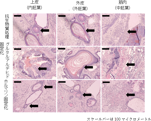 培養細胞をマウスに移植してできたテラトーマの様子の画像