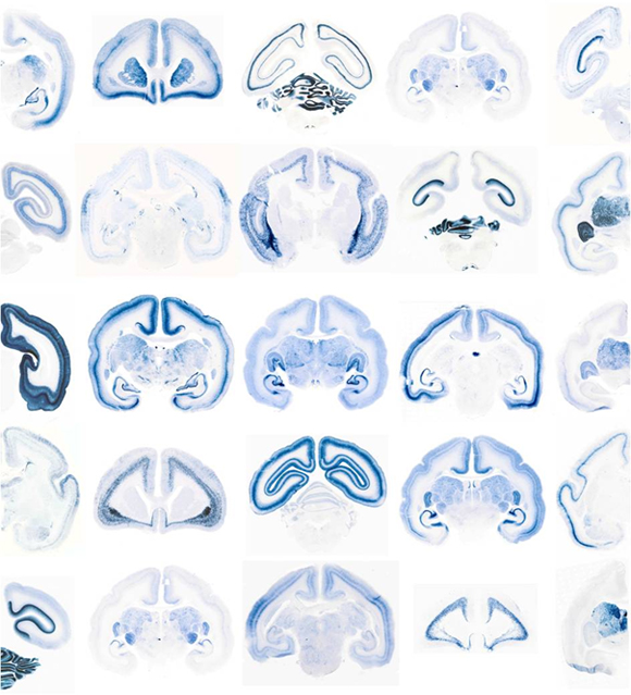 新生児のコモンマーモセットの脳内でさまざまな発現を示す遺伝子の図